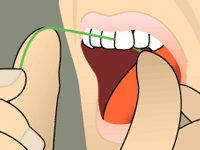 flossing illustration