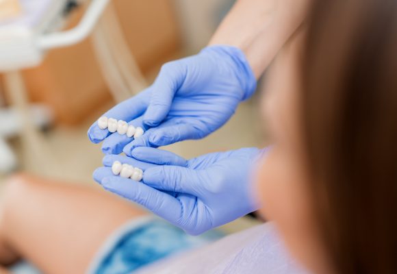 dentist showing patient composite dental bridges